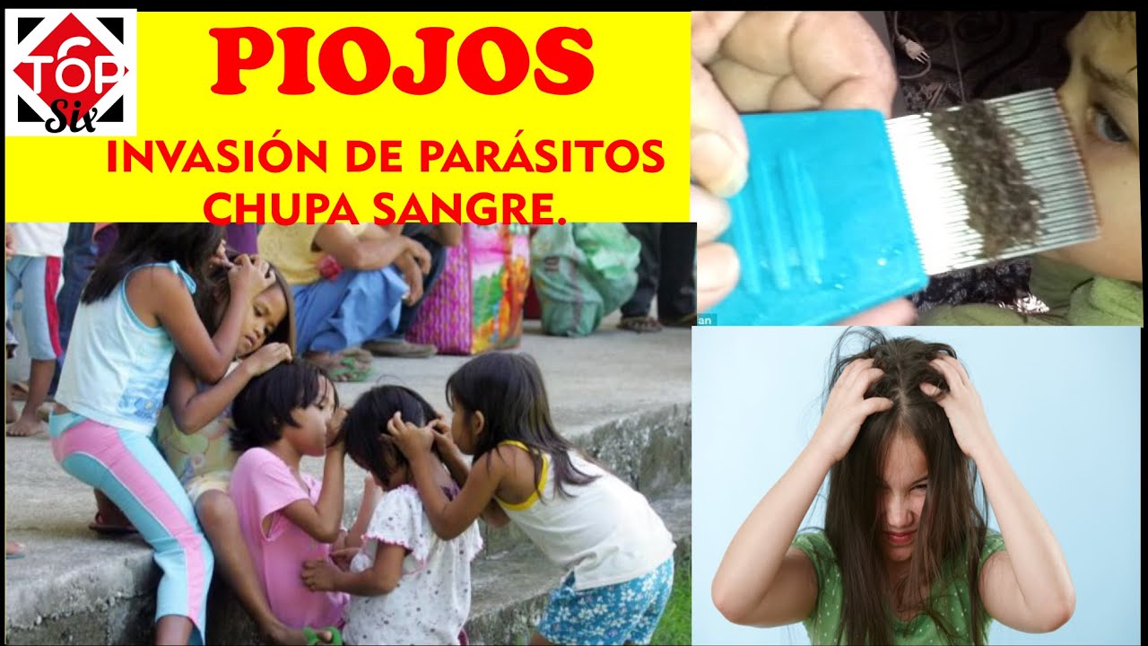 piojos y matarlos una lucha contra la invasion