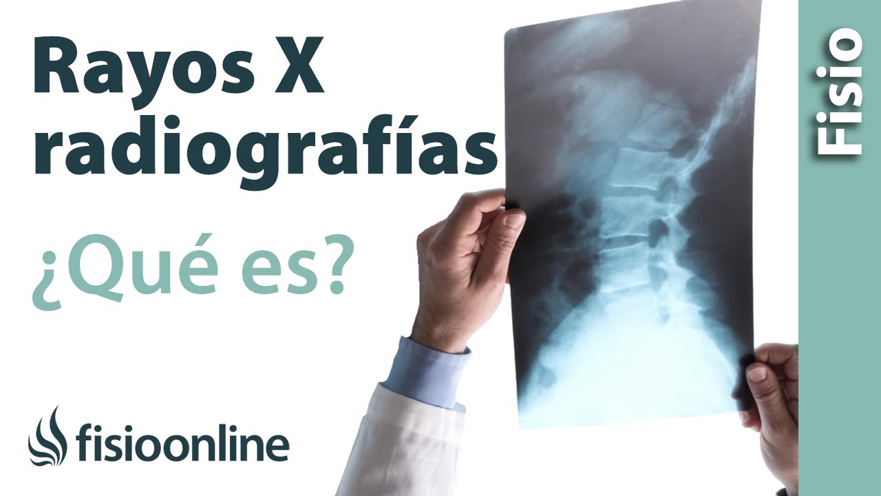 una radiografia