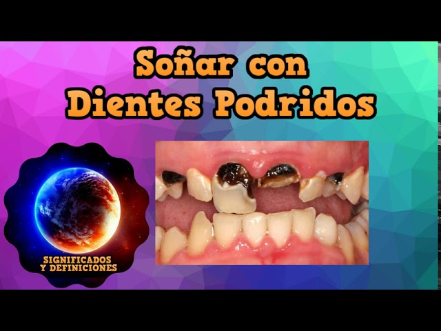 dientes podridos que significado tiene este sueno