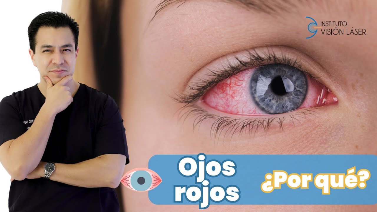 ojos rojos que significa este sueno y cual es su interpretacion