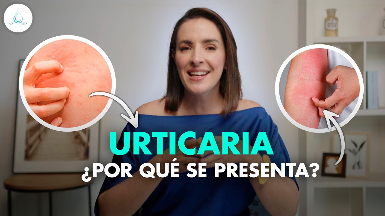 urticaria que significa este sueno y cual es su interpretacion