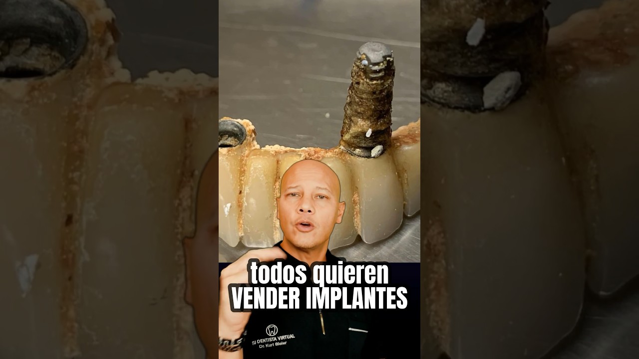 implantes dentales un mensaje sobre tu autoestima