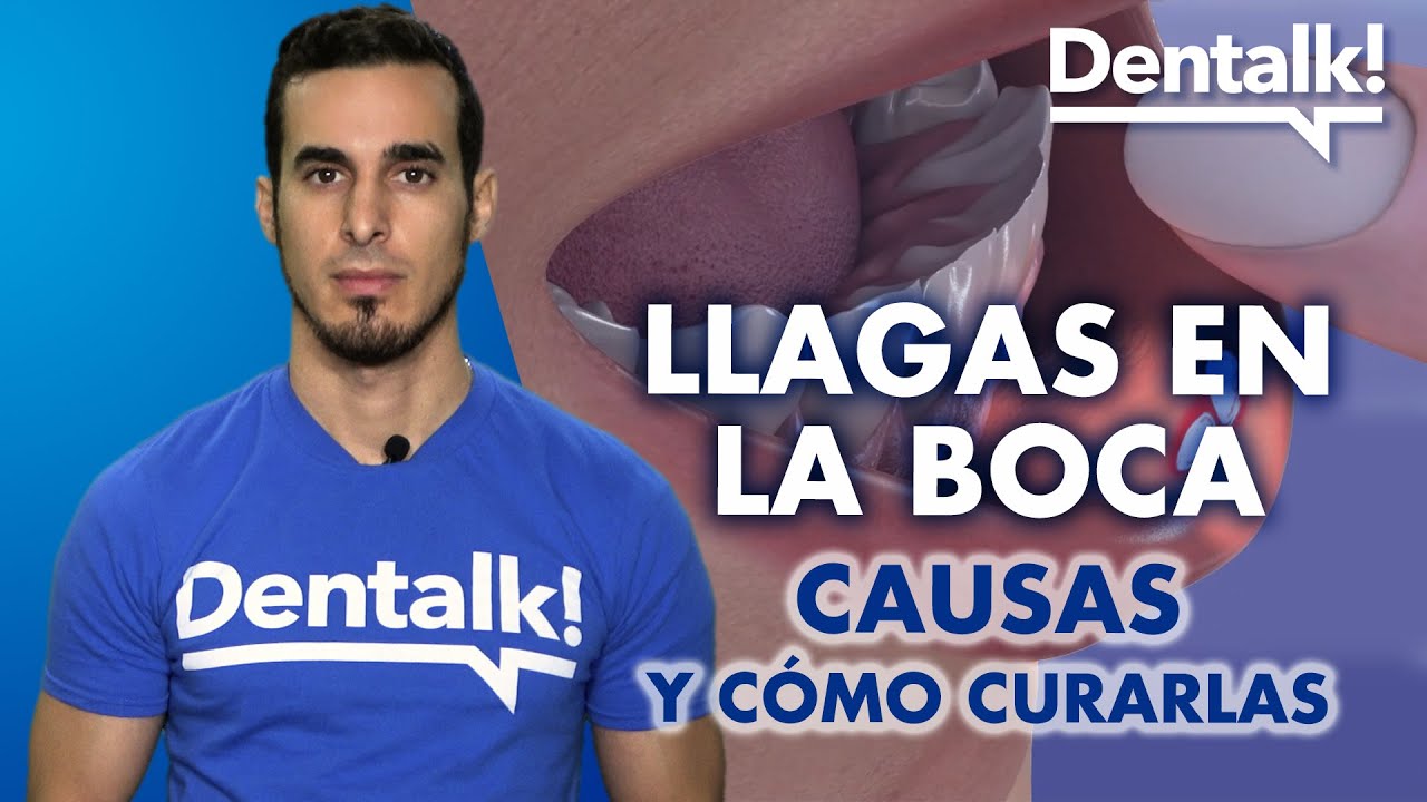 aftas en la boca que significado tiene este sueno