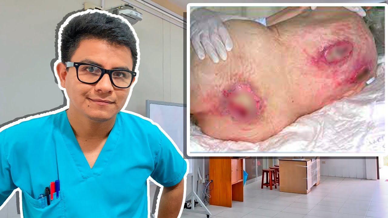llagas en el cuerpo