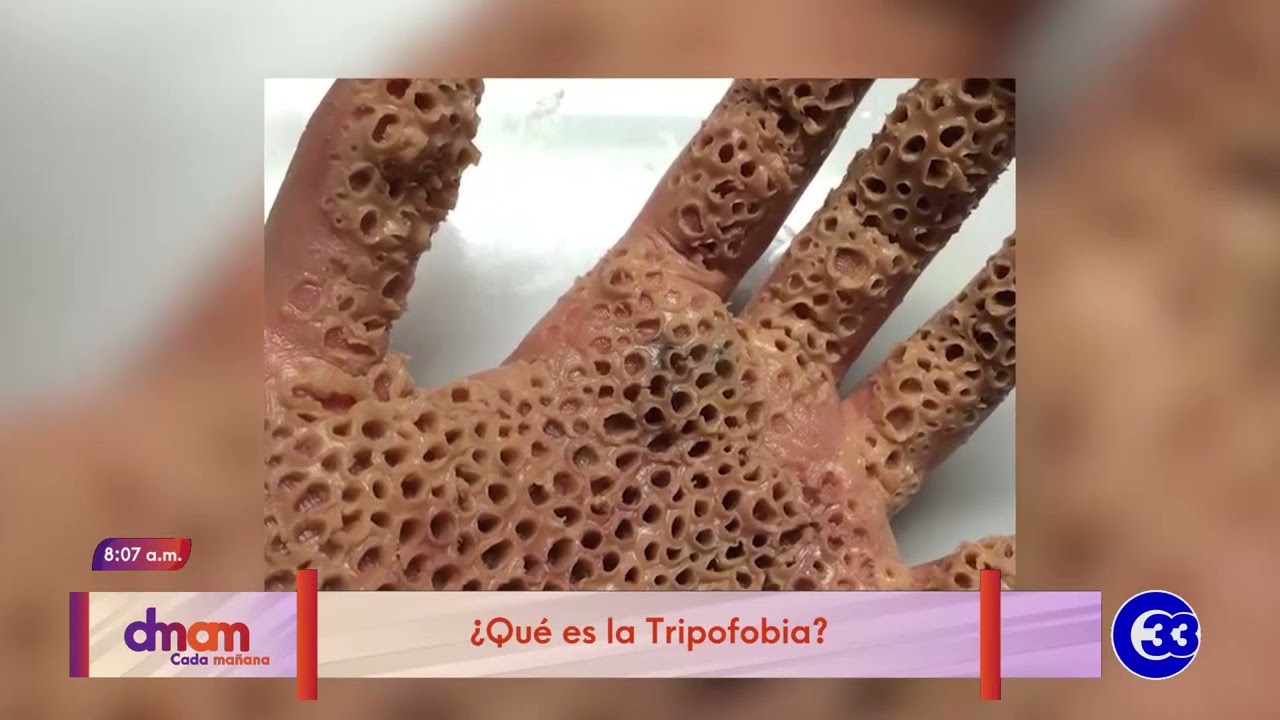 hoyos en la mano un mensaje de vulnerabilidad