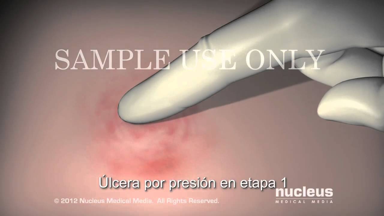ulceras en la cabeza cual es su significado