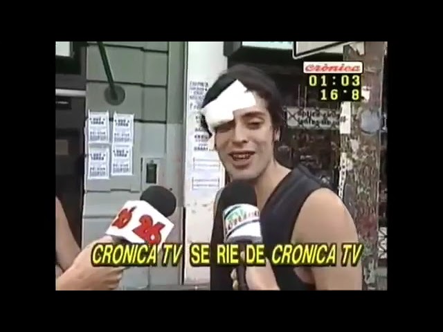 un ojo herido de otra persona