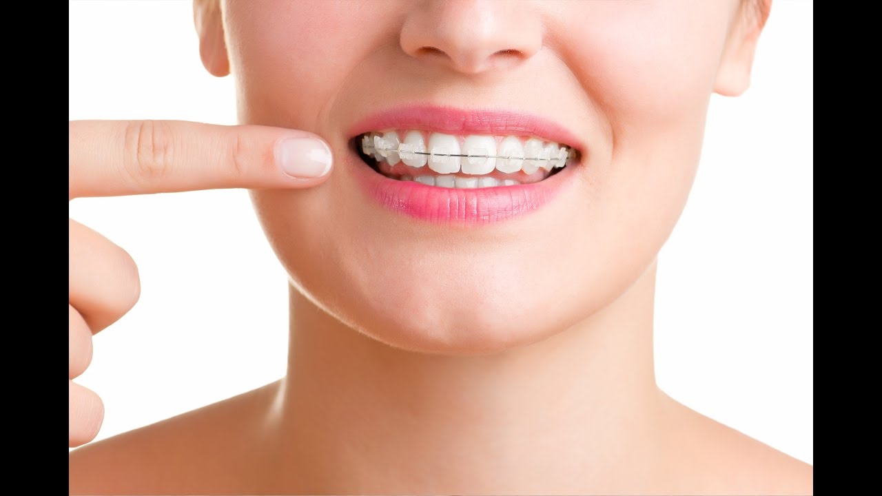 brackets interpretacion de los suenos y significado