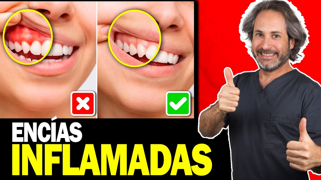 encias inflamadas que significado tiene