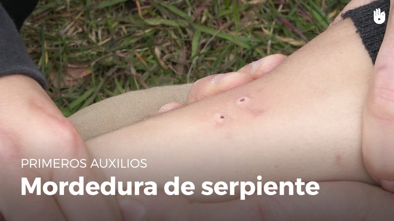 la mordedura de una serpiente