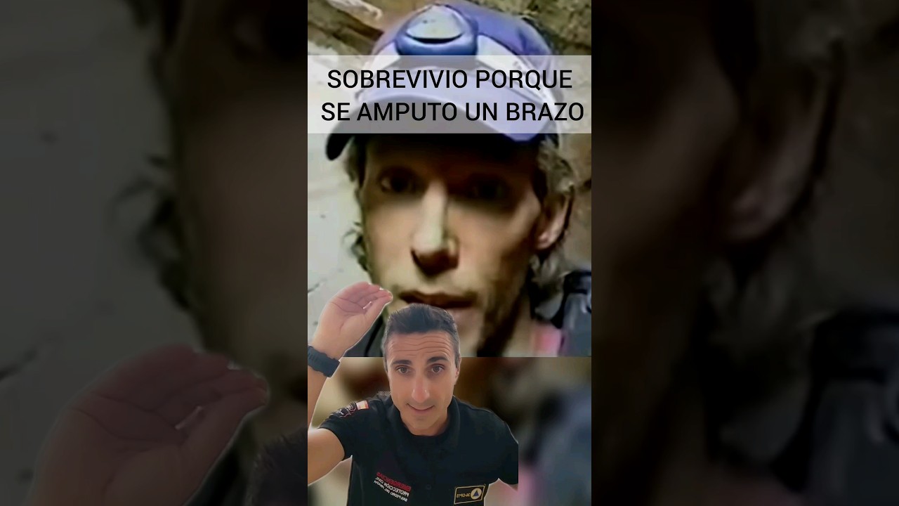 un brazo amputado
