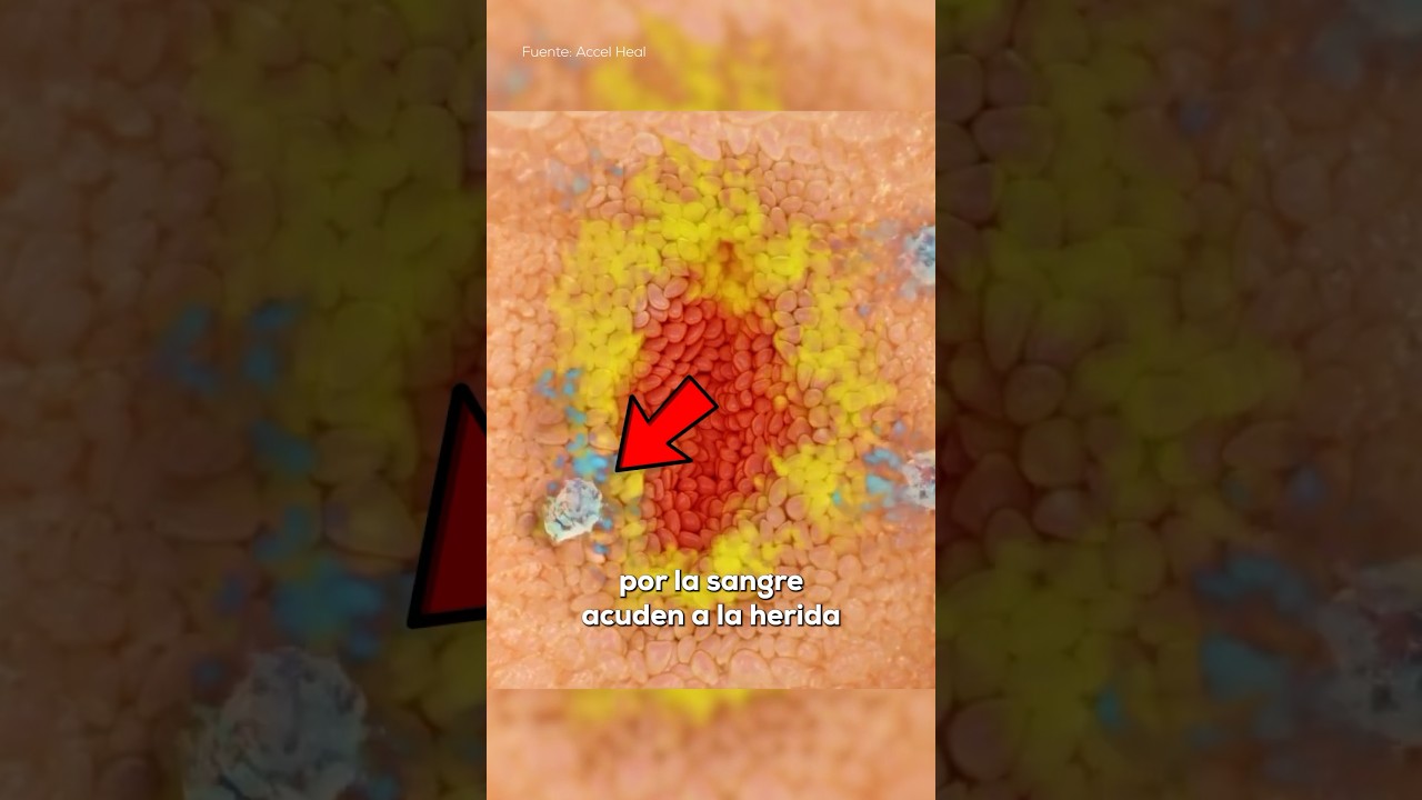 una herida abierta sin sangre
