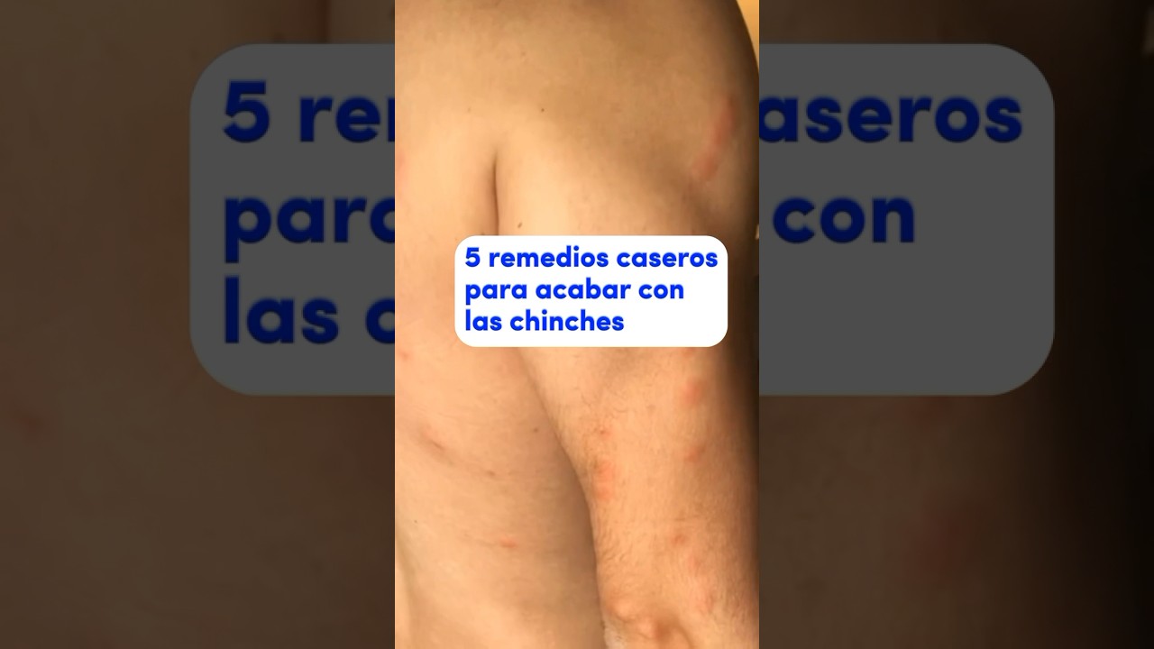 chinches y matarlas una pesadilla convertida en victoria