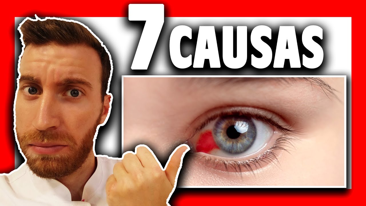 un ojo ensangrentado que significa