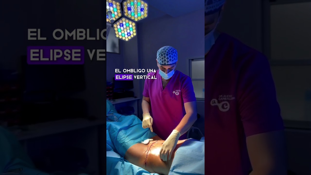 una cirugia de abdomen